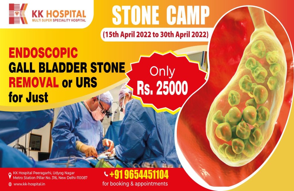 Cause, Symptoms & Treatments Of Gallbladder Stones